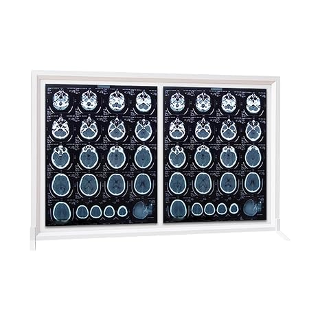 Hospital X-ray Viewing Lamp, X Ray Led Illuminator, Viewer Film Illuminator Light Box with Bracket, Stepless Dimming, No Shadows, DC 12V(75.5x49.5cm/30x19")