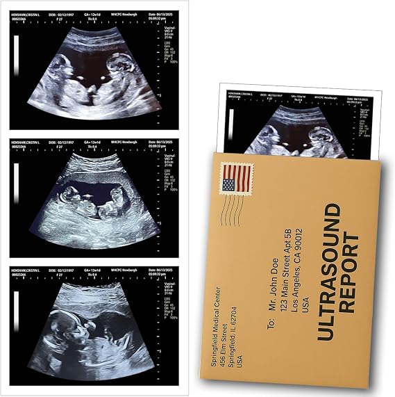 Custom Fake Pregnancy Ultrasound Photo Realistic Fake Sonogram, Personalized Joke Ultrasound Picture, Funny Gag Gift for Couples, Husband and Wife