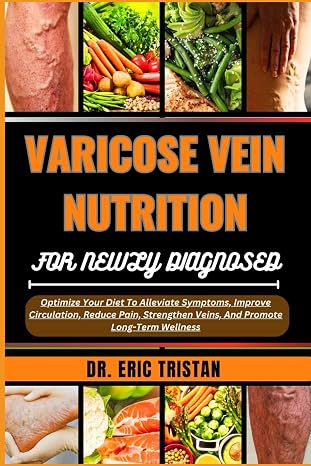 VARICOSE VEIN NUTRITION FOR NEWLY DIAGNOSED: Optimize Your Diet To Alleviate Symptoms, Improve Circulation, Reduce Pain, Strengthen Veins, And Promote Long-Term Wellness